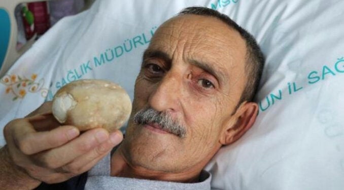 Gören inanamıyor! Elinde tuttuğu patates değil...