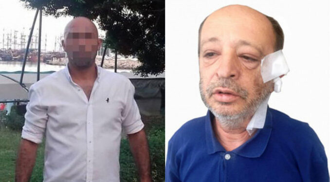 'İspiyonculuğun sonu budur' diyerek kulağını kesti!