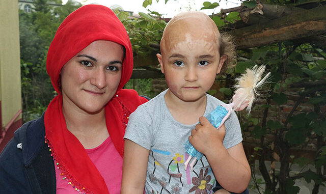 Tek hayali peruktu... Küçük Zeynep'e iyi haber