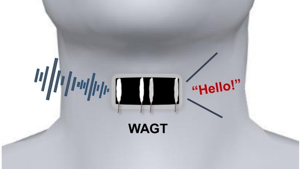 Wearable Artificial Graphene Throat