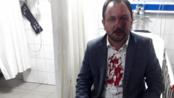 Bursa'da saldırıya uğrayan sendika başkanı hakkında şoke eden iddia!