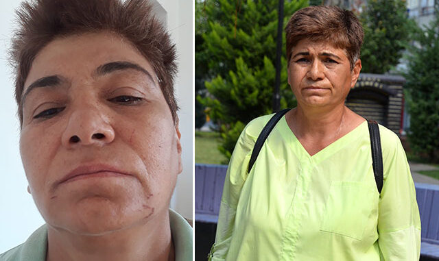 Sokak ortasında 'miras' dayağı