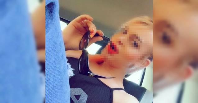 Öldürülen Trans Birey Hakkında Görgü Tanığı ‘Öldür Beni' Diye Yalvarıyordu