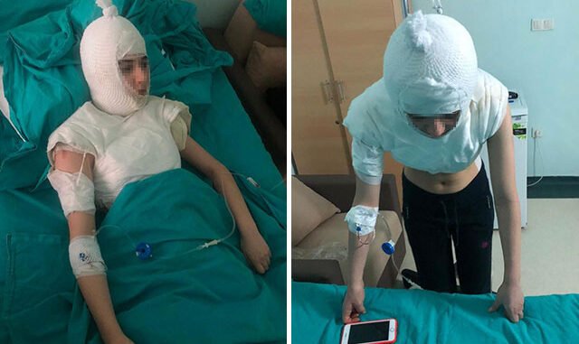'Başımdan aşağı kaynar su döktü' Üvey anne dehşeti iddiası!