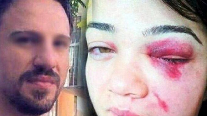 Eşine şiddet uygulayan adam elektronik kelepçeyi kırdı